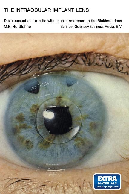 Intraocular Implant Lens Development and Results with Special Reference to the Binkhorst Lens: Proef